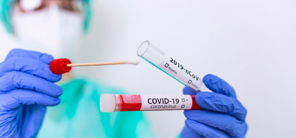 Screening Covid a Villanovaforru: 338 tamponi tutti negativi covid sardegna